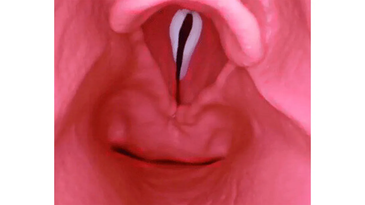 AirSim® Difficult Airway, Dark