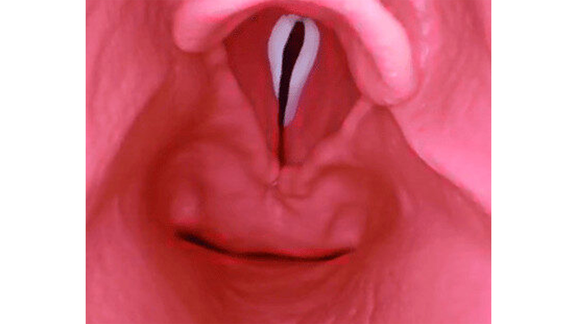 AirSim® Difficult Airway, Dark