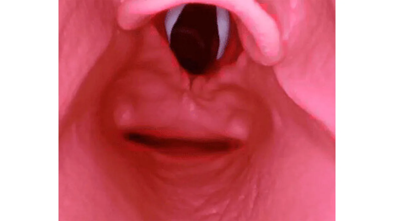 AirSim® Difficult Airway, Dark