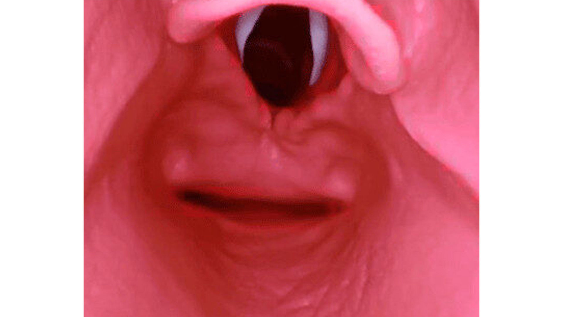 AirSim® Difficult Airway, Dark