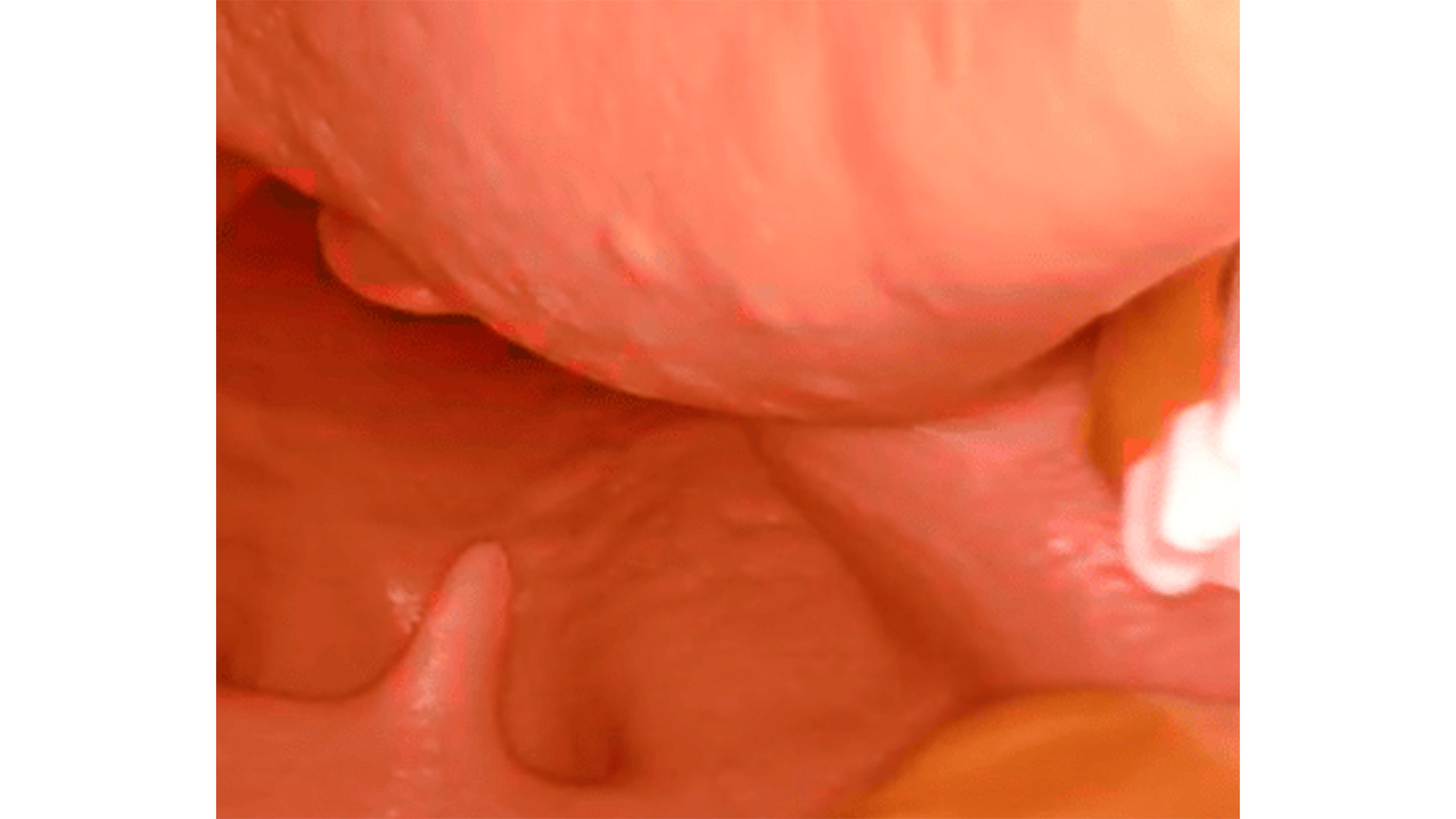 AirSim® Difficult Airway, Dark