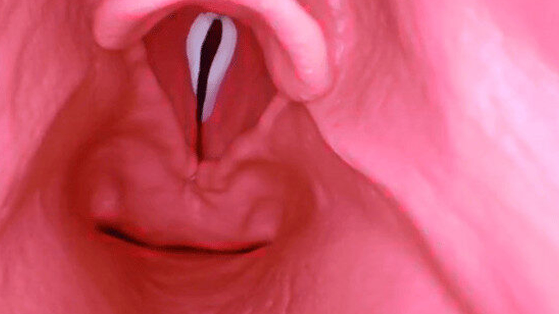 AirSim® Difficult Airway, Light