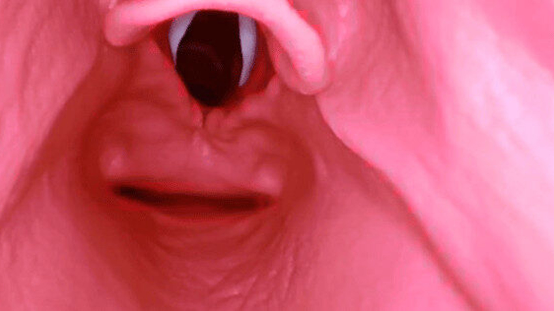 AirSim® Difficult Airway, Light