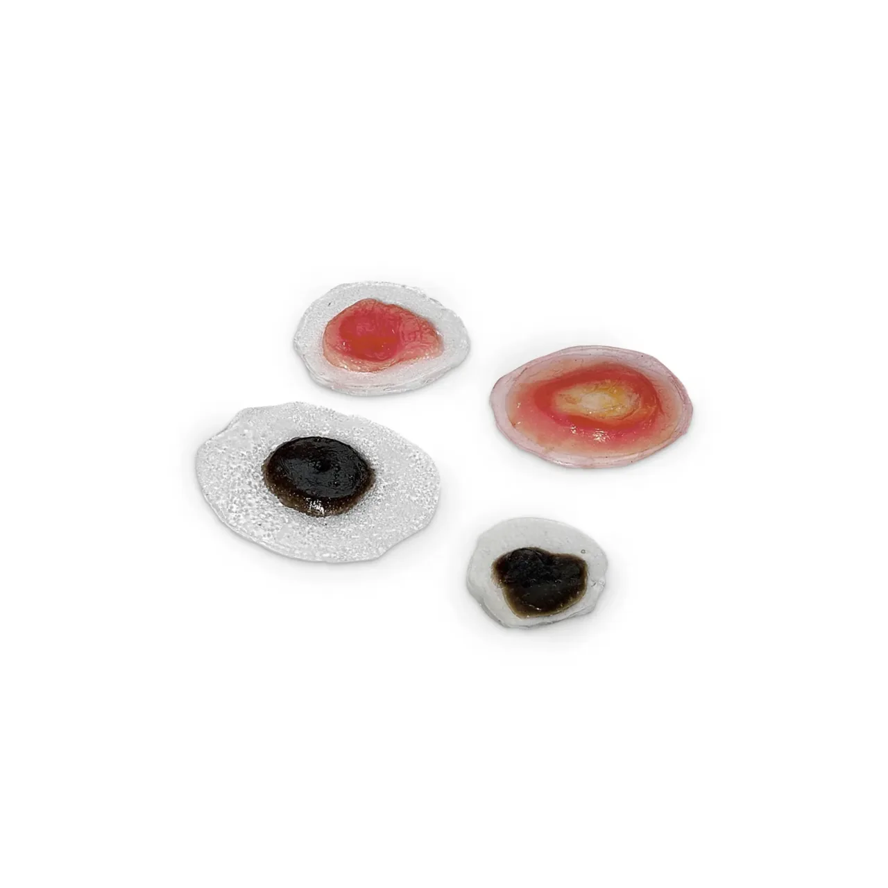 Wound - Moles/Skin Cancer