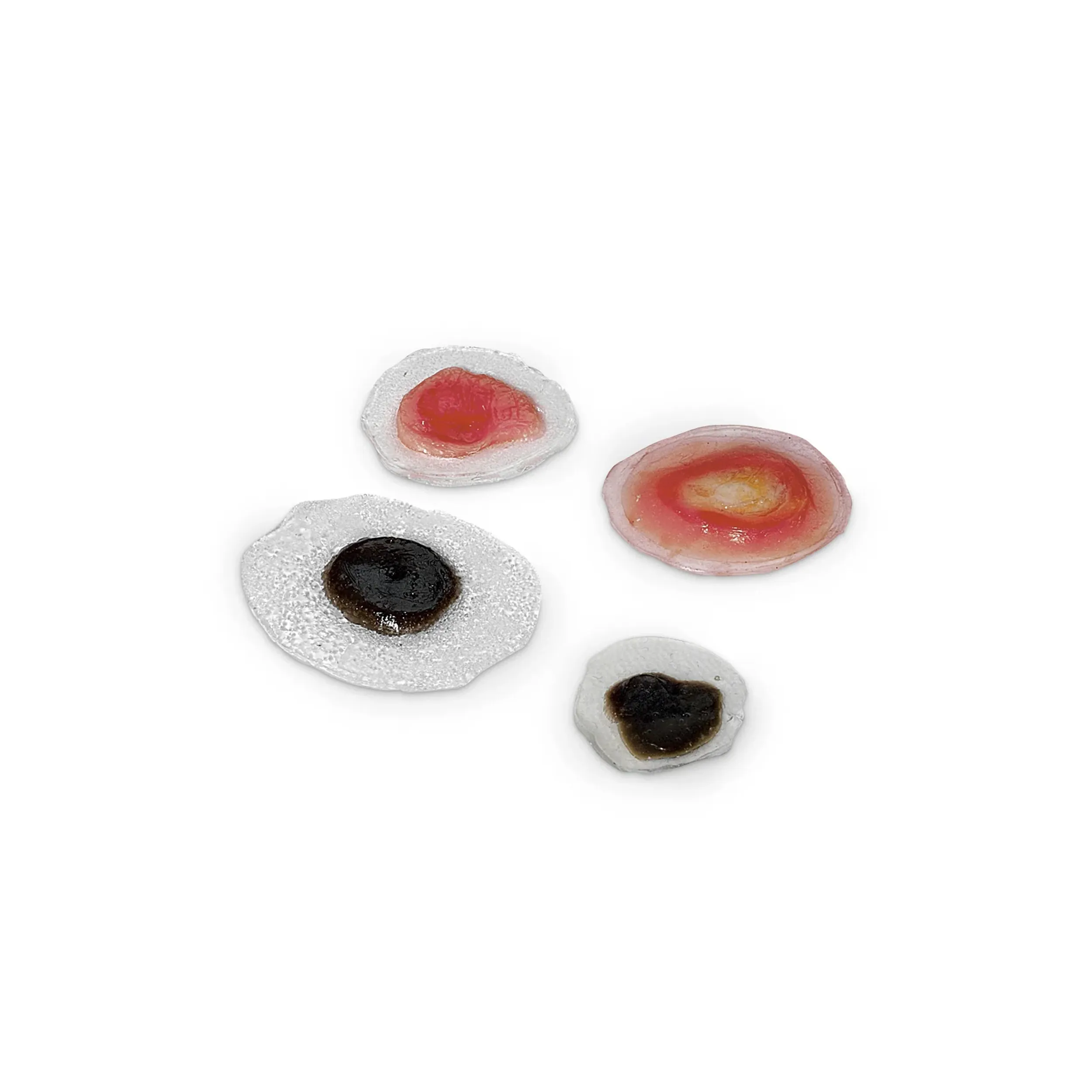 Wound – Moles/Skin Cancer