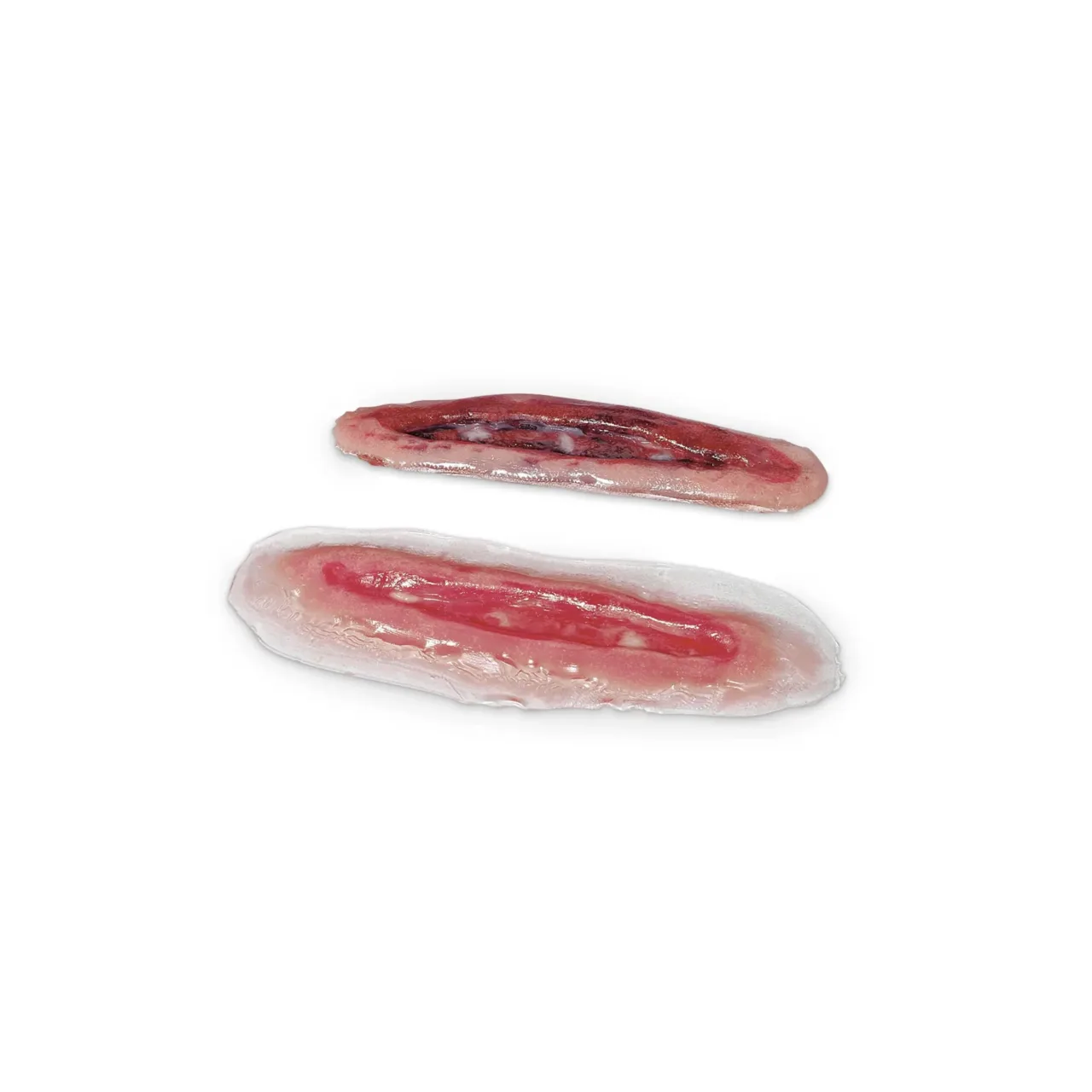Wound - Incisions