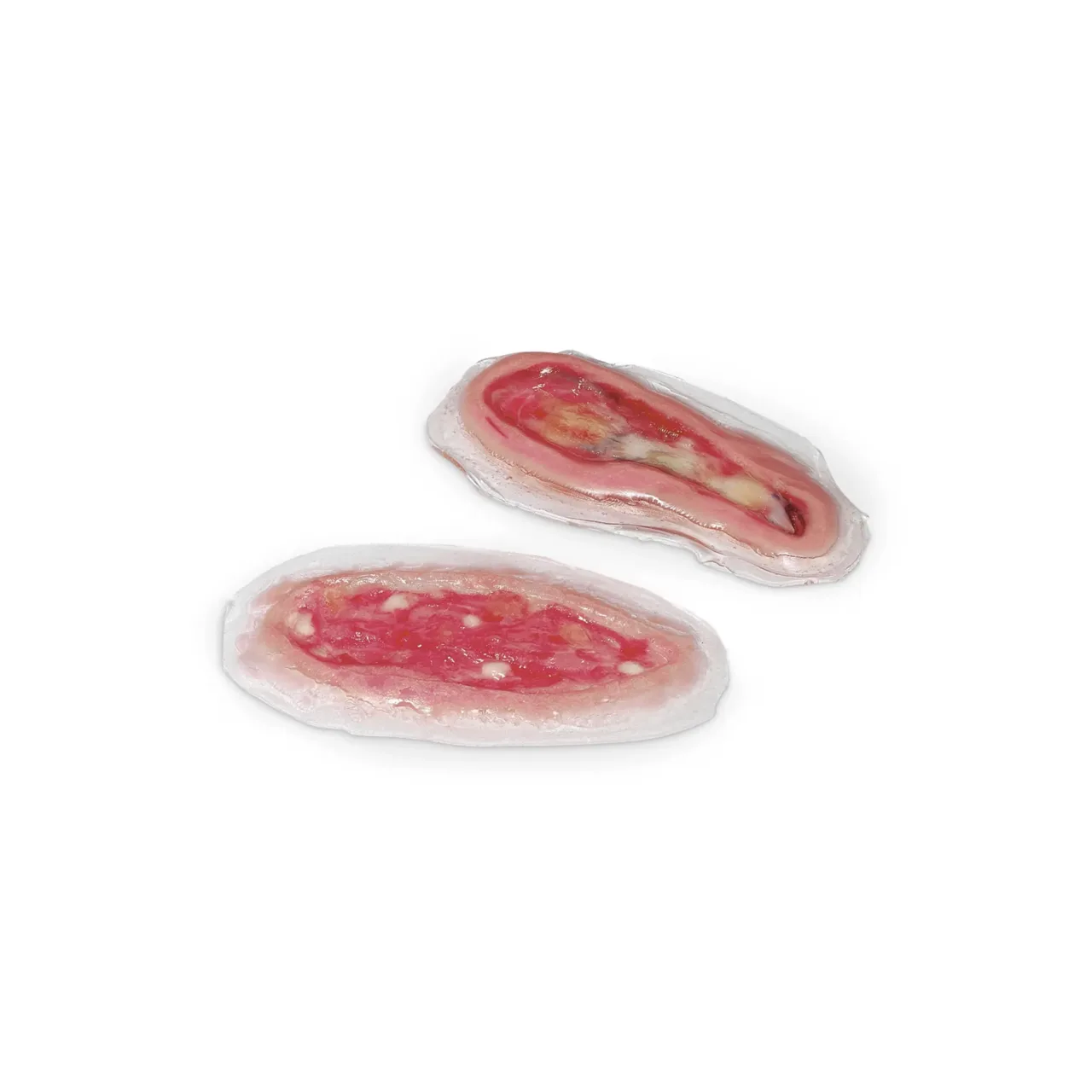 Wound – Dehiscence