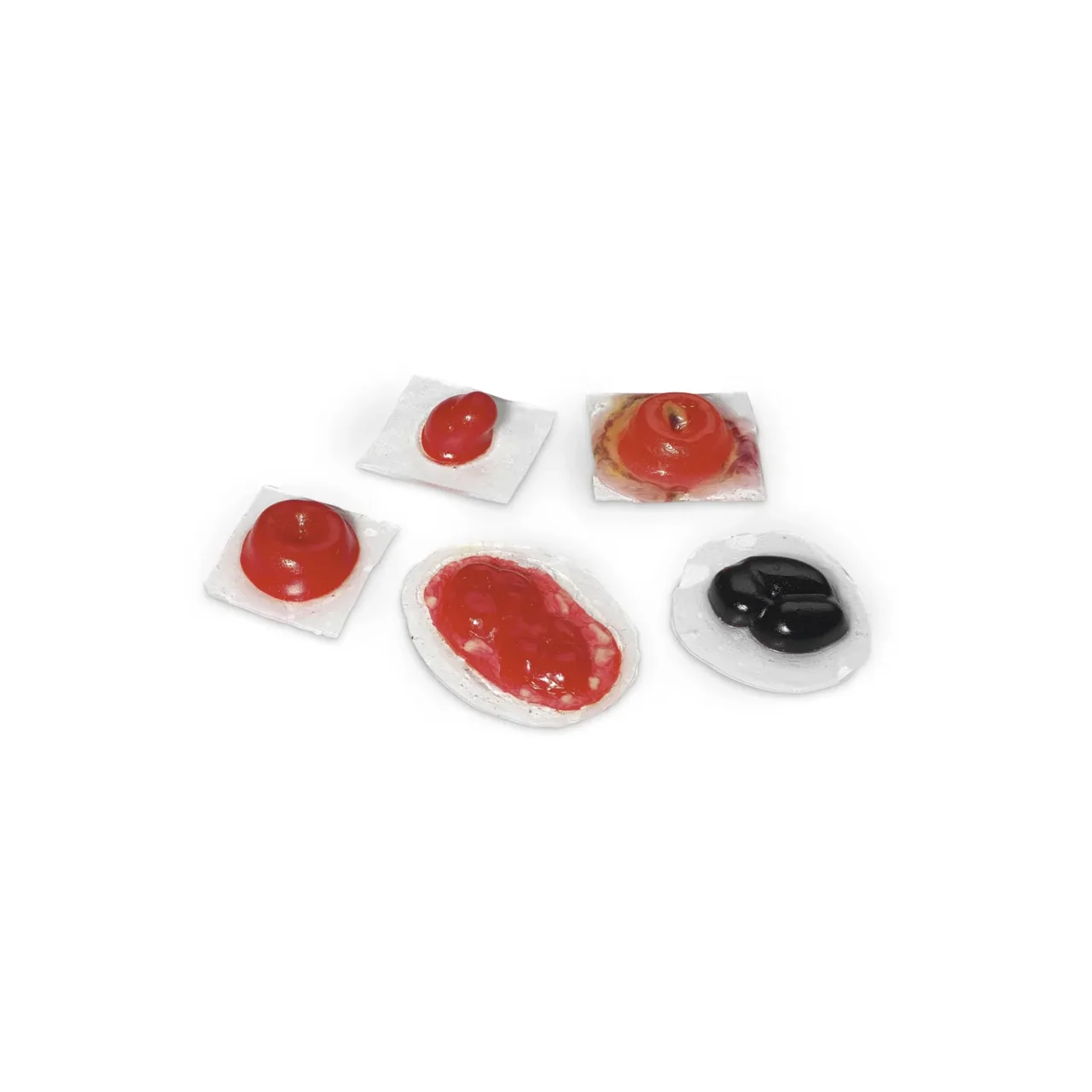 Wound – Ostomies