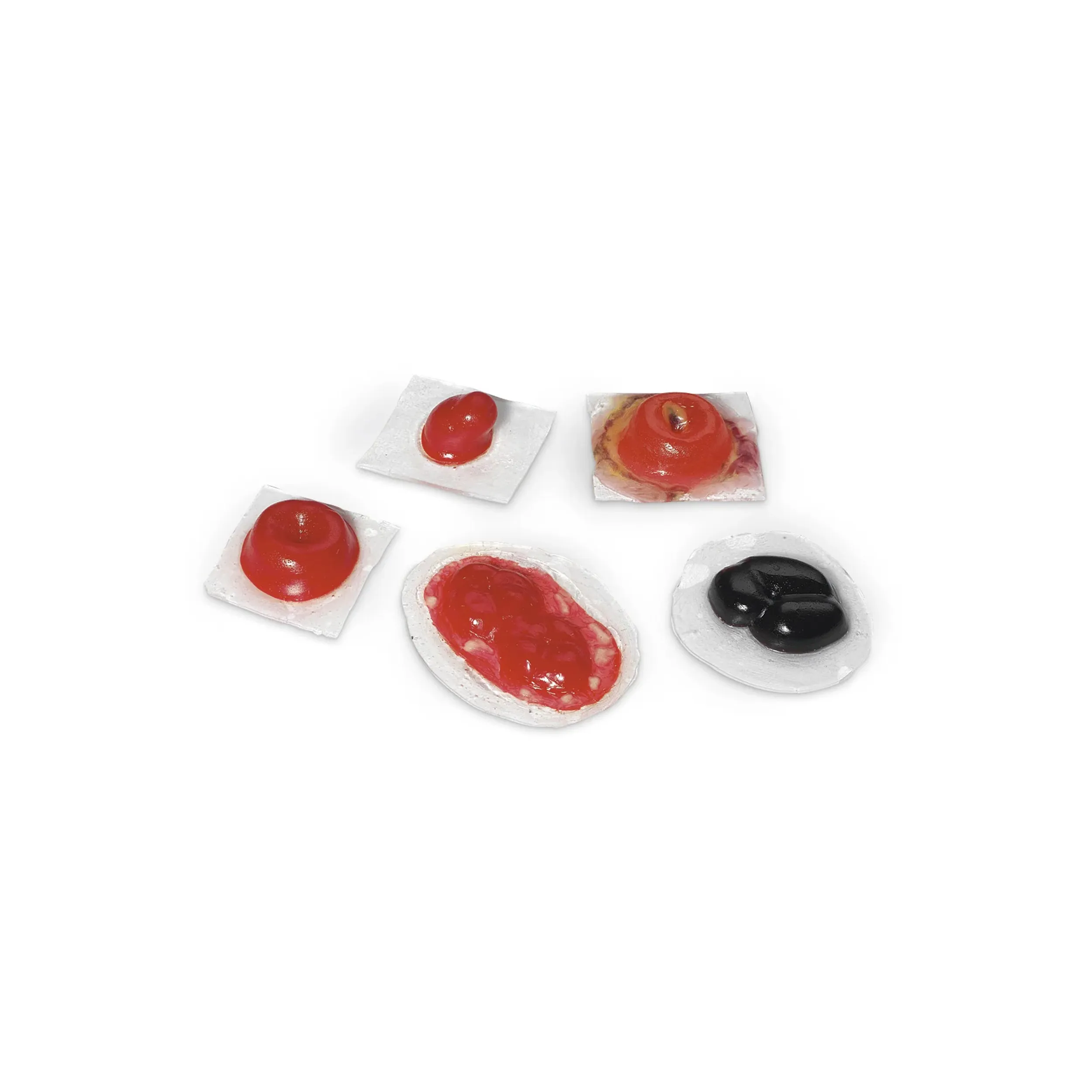 Wound – Ostomies