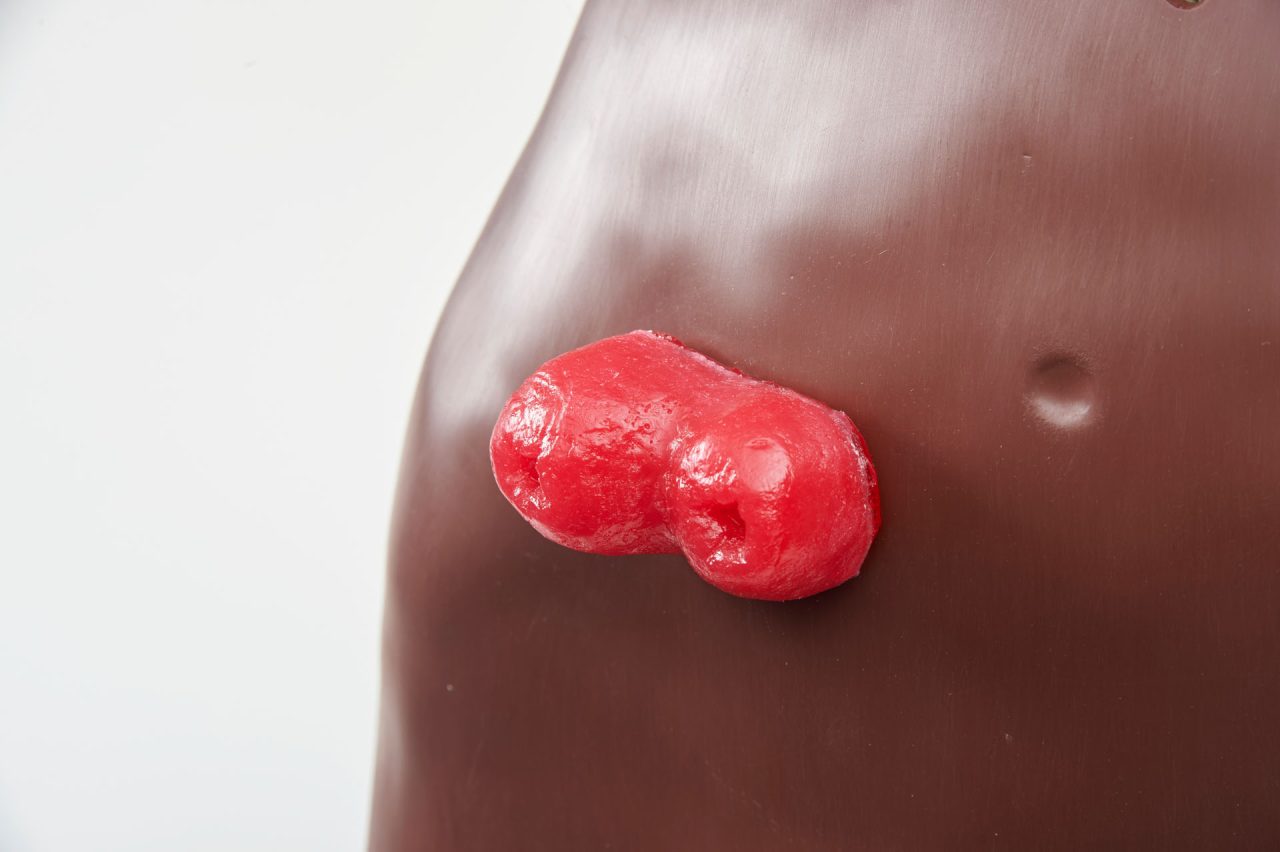 Stoma Care Torso, Dark
