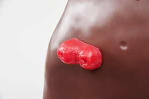 Stoma Care Torso, Dark