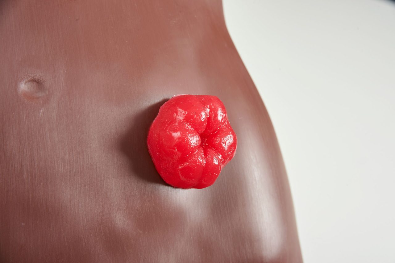 Stoma Care Torso, Dark