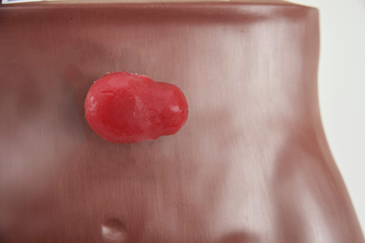 Stoma Care Torso, Dark