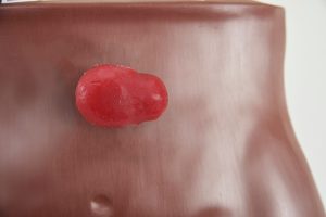 Stoma Care Torso, Dark
