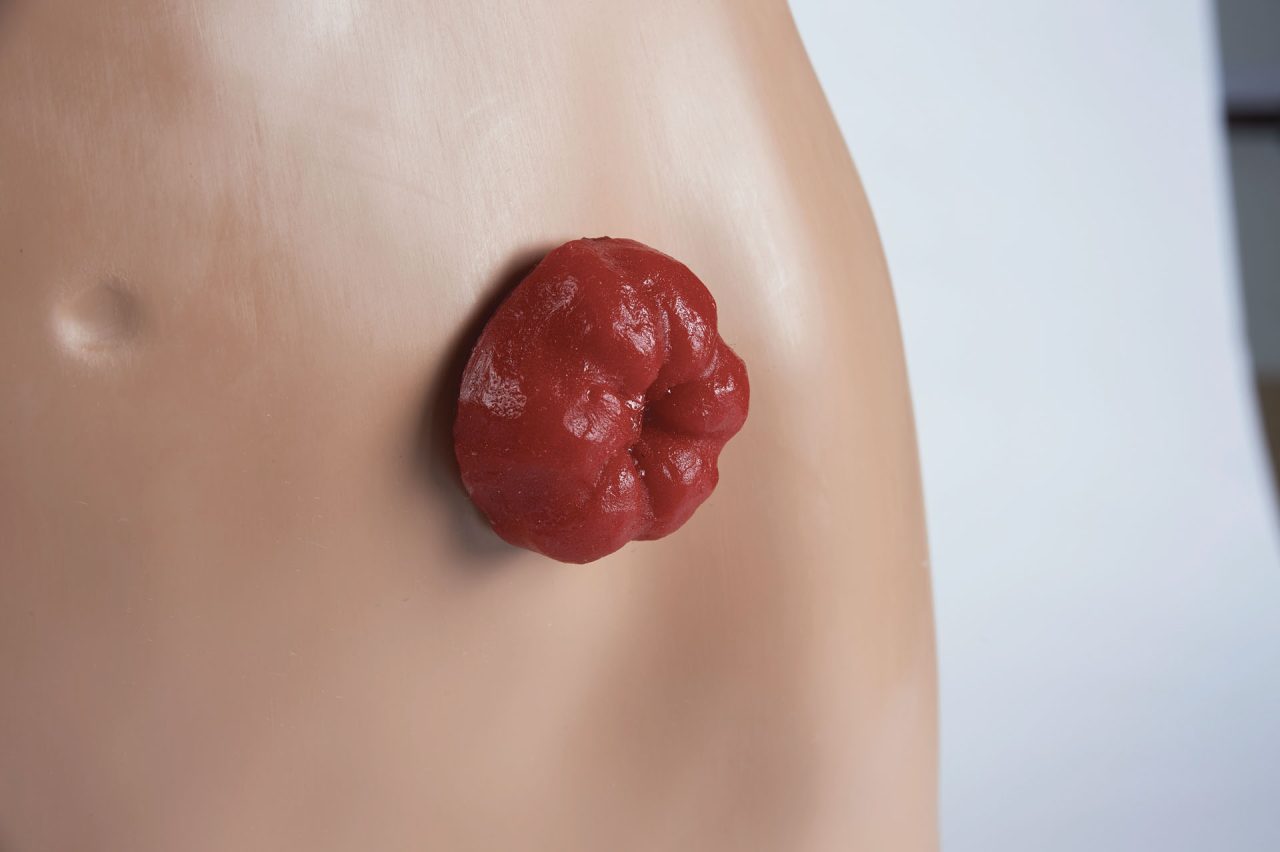 Stoma Care Torso, Light