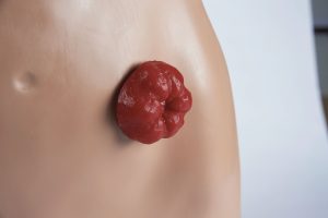 Stoma Care Torso, Light