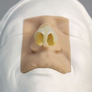Rhinoplasty Model