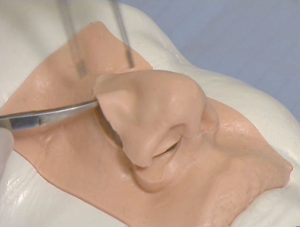 Rhinoplasty Model