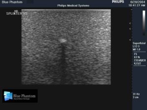 Leg With Foreign Body Identification Insert for Ultrasound Training, EX-DEMO MODEL