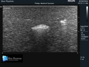 Leg With Foreign Body Identification Insert for Ultrasound Training, EX-DEMO MODEL