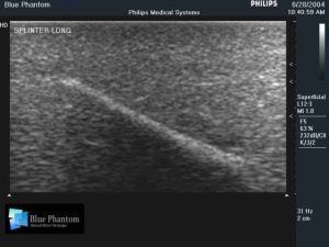 Leg With Foreign Body Identification Insert for Ultrasound Training, EX-DEMO MODEL