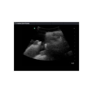 Tissue Insert for Paracentesis Ultrasound Model ABP082/ABP083/ABP084