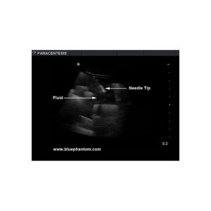 Tissue Insert for Paracentesis Ultrasound Model ABP082/ABP083/ABP084