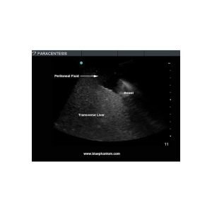 Tissue Insert for Paracentesis Ultrasound Model ABP082/ABP083/ABP084
