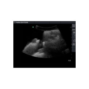 Tissue Insert for Paracentesis Ultrasound Model ABP082/ABP083/ABP084