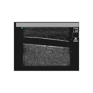 Tissue Insert for Paracentesis Ultrasound Model ABP082/ABP083/ABP084