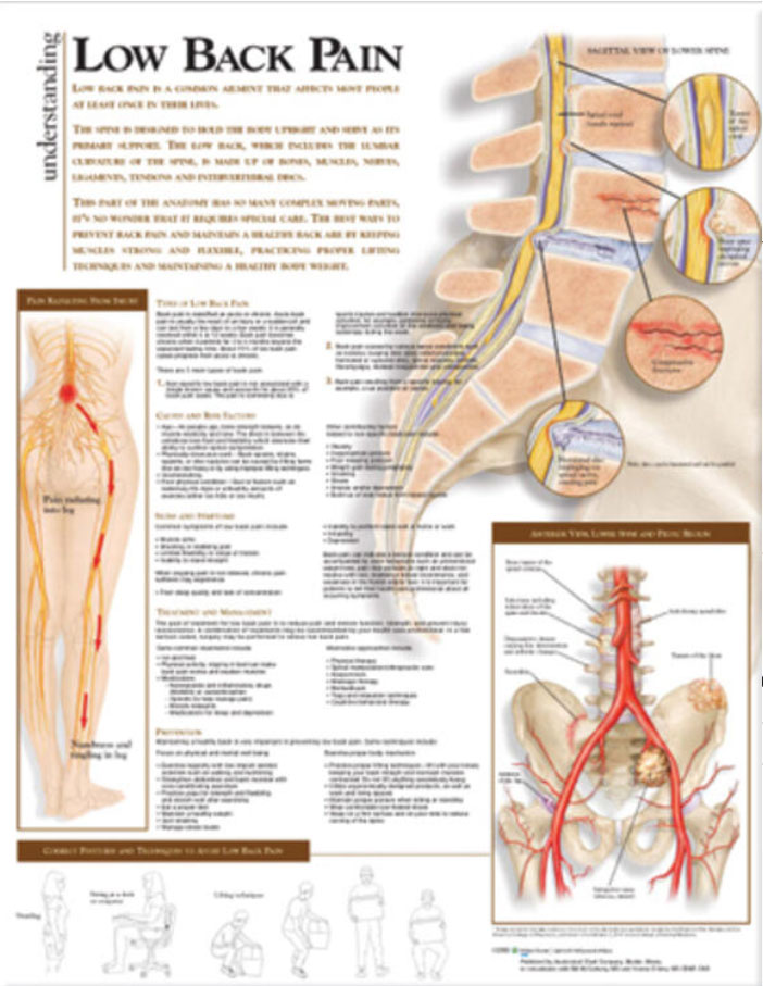 Understanding Low Back Pain Chart