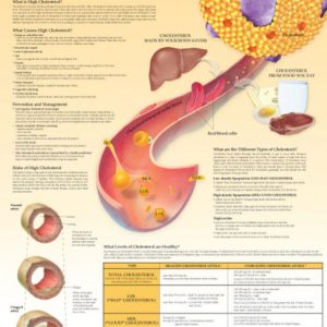 Understanding High Cholesterol