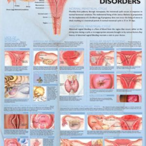 Common Gynecological Disorders Chart