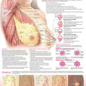Understanding Breast Cancer