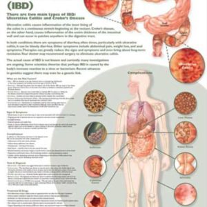 Understanding Inflammatory Bowel Disorder Chart