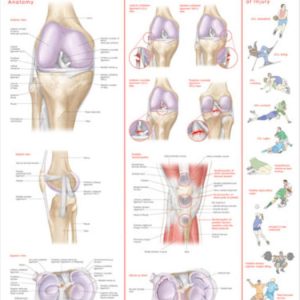 Athletic Injuries of the Knee Chart