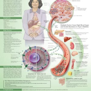 Understanding Type 2 Diabetes Chart