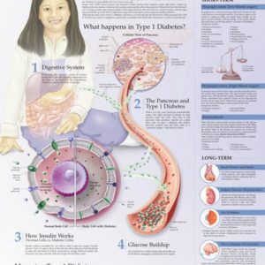 Understanding Type 1 Diabetes Chart