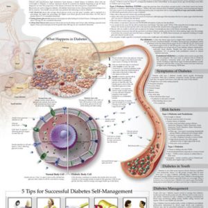 Understanding Diabetes Chart