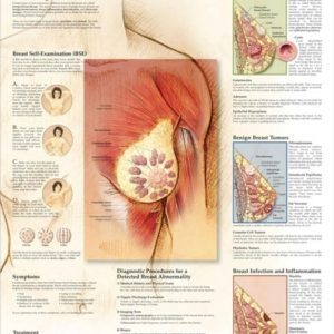 Benign Breast Disease Chart