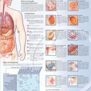 Sexually Transmitted Infections Chart