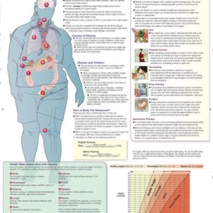 Risks of Obesity Chart