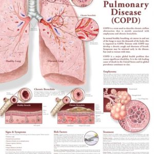 Chronic Obstructive Pulmonary Disease Chart