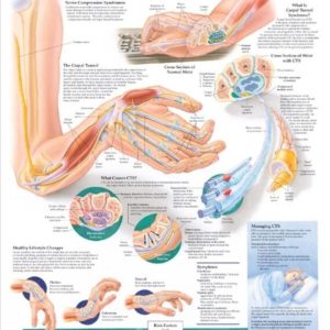 Understanding Carpal Tunnel Syndrome Chart