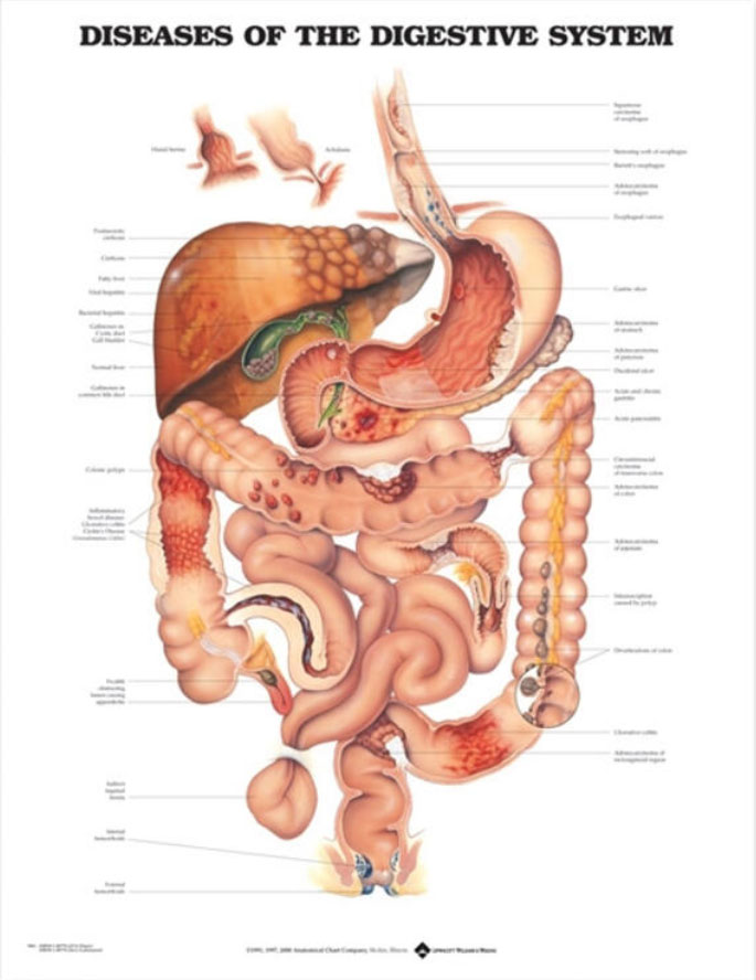 Diseases of Digestive System Chart