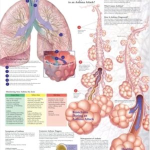 Understanding Asthma Chart