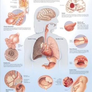 Dangers of Smoking Chart