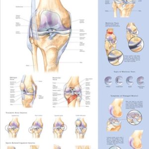 Knee Injuries Chart