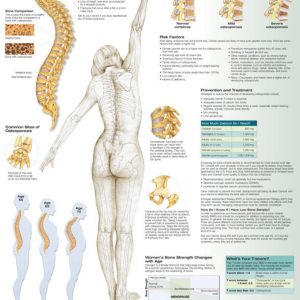 Understanding Osteoporosis Chart