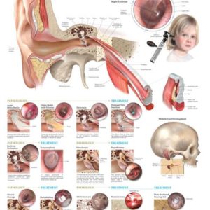 Middle Ear Conditions Chart